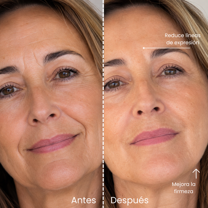 Zenkora™ — Kit completo